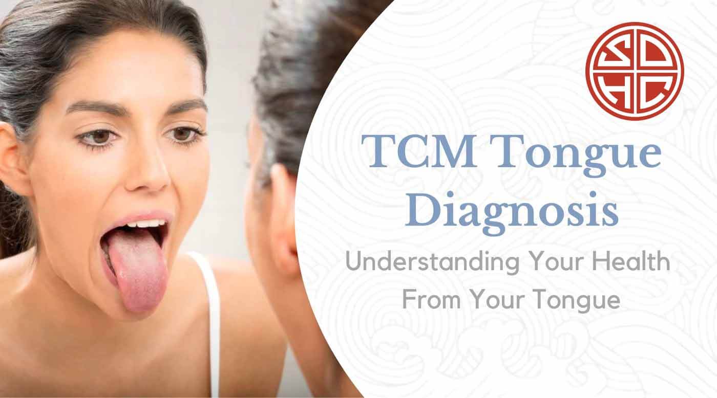 TCM Tongue Diagnosis Understanding Your Health from Your Tongue